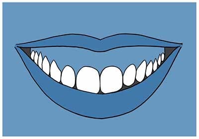 Sonrisa Gingival Sonrisa Gingival