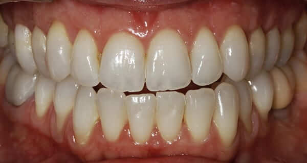 periodoncia despues periodoncia despues