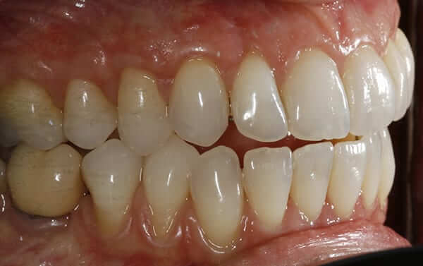 After right periodoncia After right periodoncia