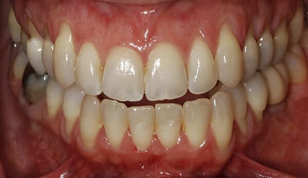 periodoncia antes 1 periodoncia antes 1