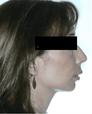 Cirurgia Ortognàtica