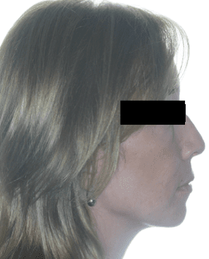 Cirurgia Ortognàtica