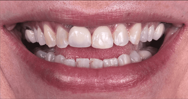 Estètica Dental