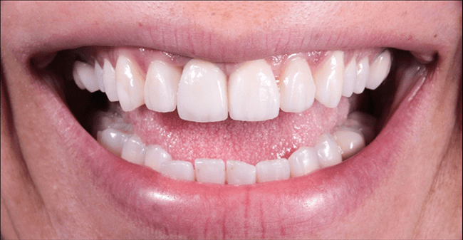 Estètica Dental