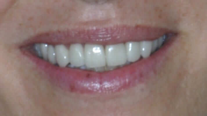 post 2