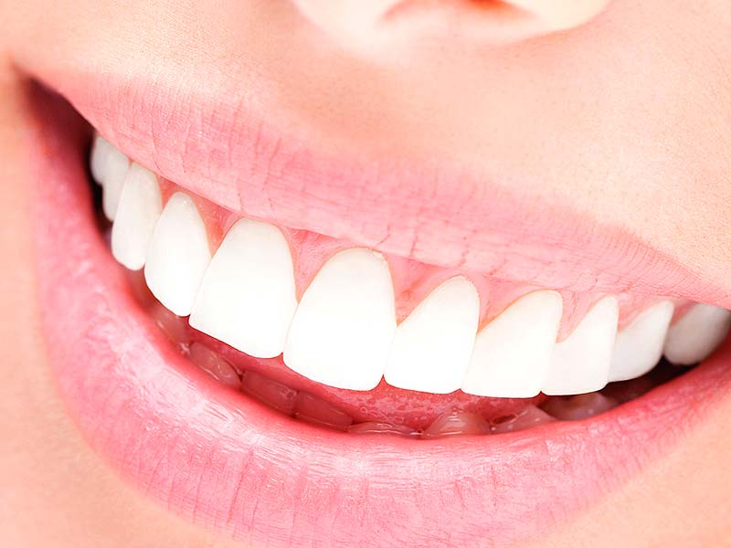 Dientes blancos