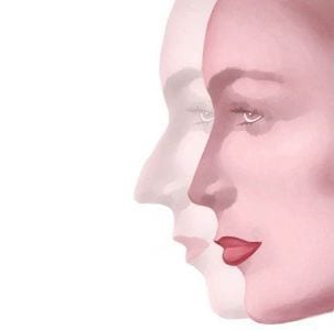 Rinoplastia Rinoplastia