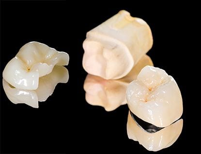 Incristacion odongologia Incristacion odongologia