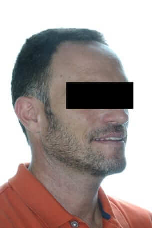 Cirurgia Ortognàtica