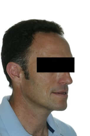 Cirurgia Ortognàtica