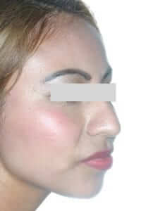 INICIO-XXSS-1