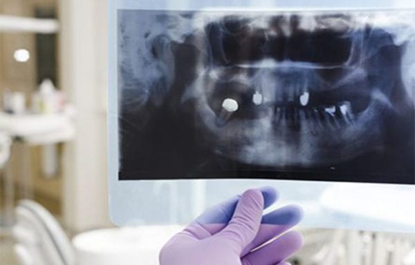 odontologia integral radiografia odontologia integral radiografia
