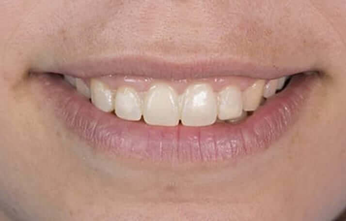 Estética dental - Smile Design